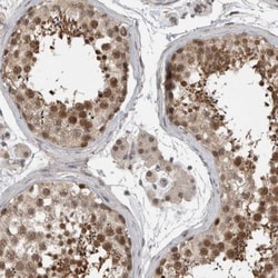 ZNF341 Antibody, Novus Biologicals:Antibodies:Primary Antibodies